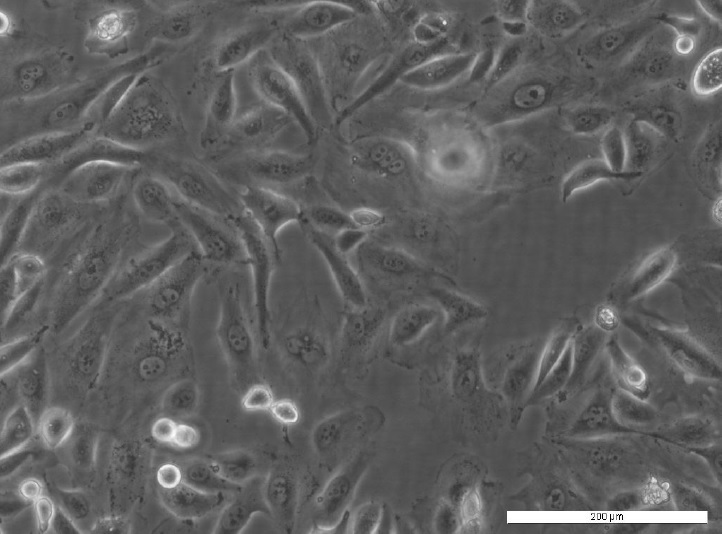 PEA1 Cell Line.Image courtesy of the European Collection of Authenticated Cell Cultures (ECACC)