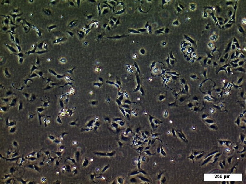 BICR 10 Cell Line. Image courtesy of the European Collection of Authenticated Cell Cultures (ECACC)