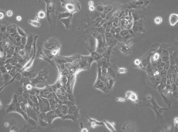 BICR 31 Cell Line. 48 hours post plating. Image courtesy of the European Collection of Authenticated Cell Cultures (ECACC).
