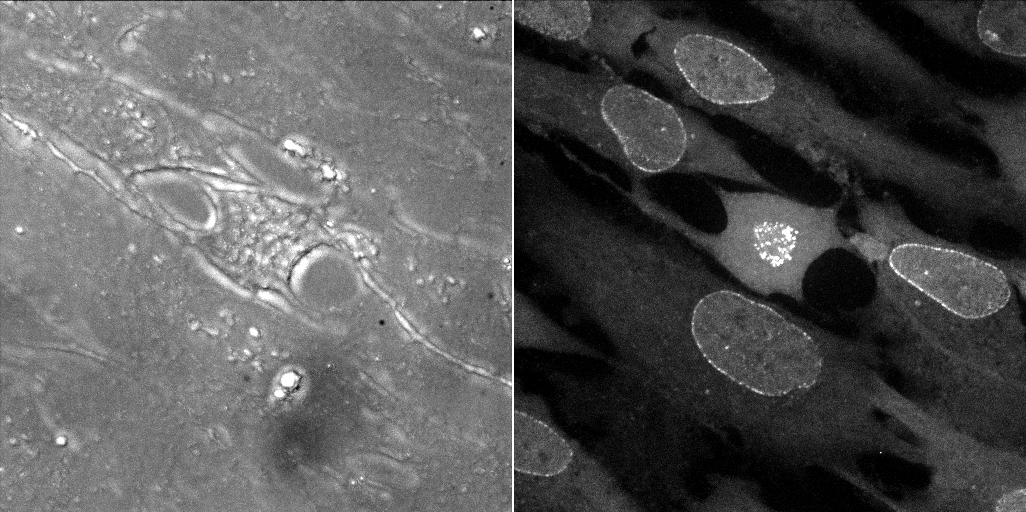 Ruby-Mad2 Reporter Cell Line, early metaphase