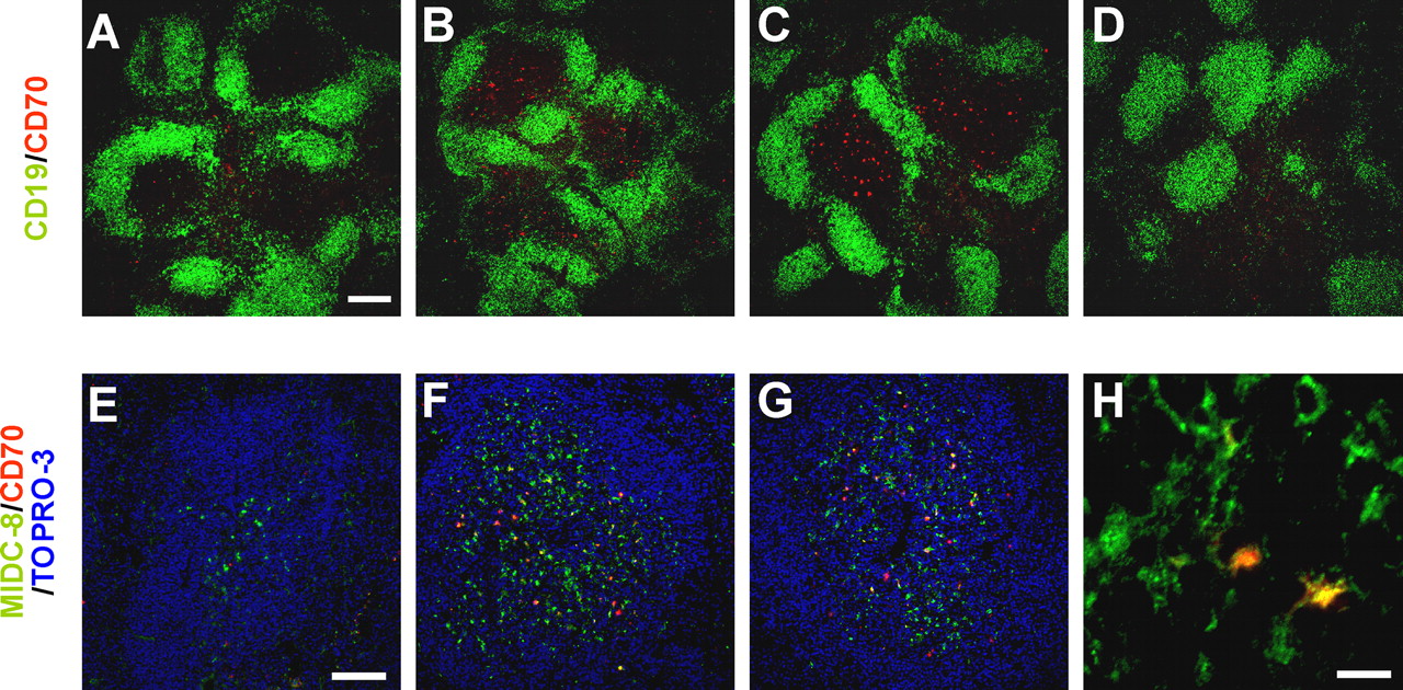 Adapted from Taraban VY, Martin S, Attfield KE, Glennie MJ, Elliott T, Elewaut D, Van Calenbergh S, Linclau B, Al-Shamkhani A. Invariant NKT cells promote CD8+ cytotoxic T cell responses by inducing CD70 expression on dendritic cells. J Immunol. 2008 Apr 1;180(7):4615-20. doi: 10.4049/jimmunol.180.7.4615. PMID: 18354184. Administration of αGalCer triggers CD70 on DCs in the T cell areas of the spleen. Ten-micrometer frozen spleen sections obtained from mice treated with αGalCer (2 μg/animal, given i.v.) for the times indicated and stained with anti-CD70 (red) and CD19 (B cell specific, green; A–D) or anti-CD70 (red) and MIDC-8 (T cell zone DC specific, green; E–H). CD70 expression, which is undetectable in spleen sections of naive mice (A), is evident in the T cell areas 20 h (B) and 48 h (C) after αGalCer treatment. Coadministration of anti-CD40L mAb blocked αGalCer-induced expression of CD70 (D; data from 48-h time point). Expression of CD70 following the administration of αGalCer is confined to DCs in the T cell areas (colocalization signal, yellow) (E, naive; F, 20 h; G and H, 48 h). Sections were counterstained with TOPRO-3 (blue; E–G). Bars, 200 μm (A), 100 μm (E), and 10 μm (H). The data shown are representative of at least two independent experiments.