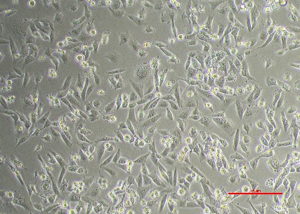 BR58 Cell Line - image captured with a x10 objective lens.