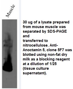 Image for Anti-ANO5 [5F7]