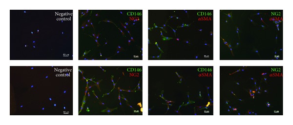 Coexpression of pericyte markers on MSCs after direct coculture with EPCs for 7 days in IMDM-FCS (top row) or IMDM-PL (bottom row). Immunofluorescence staining for CD146, NG2, and αSMA demonstrated double positive cells for each combination (CD146 and NG2, CD146 and αSMA, and NG2 and αSMA). Negative controls were stained only with the fluorescent labelled secondary antibody. Cell nuclei are stained with DAPI (blue). Scale bars = 50 μm.

Adapted from Loibl M  et al. Direct cell-cell contact between mesenchymal stem cells and endothelial progenitor cells induces a pericyte-like phenotype in vitro. Biomed Res Int 2014:395781 (2014)