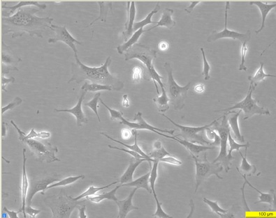 MEF ULK1/2 WT(SV40) Cell Line. 24 hours post plating. Image courtesy of the European Collection of Authenticated Cell Cultures (ECACC)