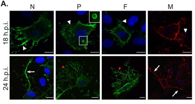 Adapted from El Najjar et al. 2016. PLoS Pathog; 12(9):e1005922. PMID: 27683250. Figure. HMPV infected BEAS-2B cells at 18 or 24 h.p.i., were fixed and processed for immunofluorescence stained with antibody against for HMPV N protein, P protein and F protein (hMPV24).