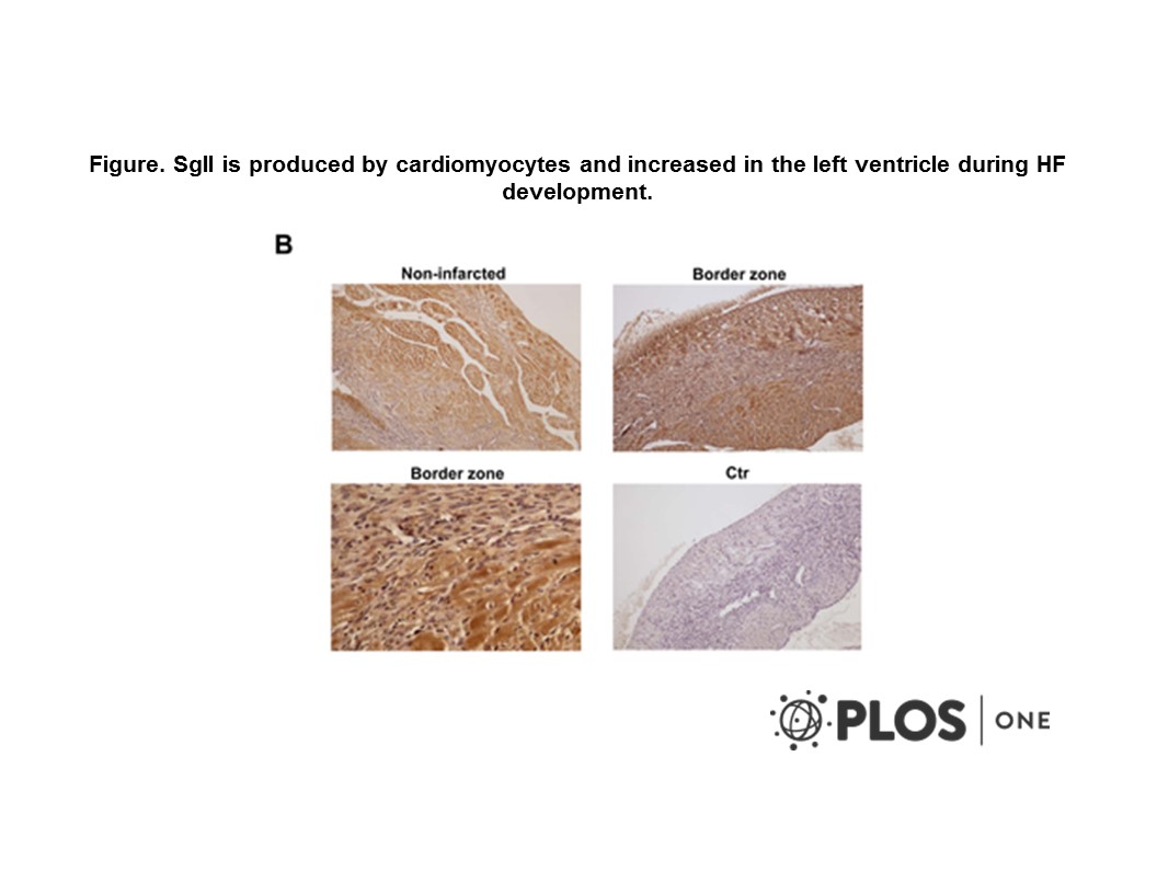 Adapted from Røsjø et al. 2012. PLoS One. 7(5):e37401. PMID: 22655045. Figure. SgII is produced by cardiomyocytes and increased in the left ventricle during HF development. B, Representative photomicrographs of myocardial tissue sections of a HF mouse demonstrating SgII immunoreactivity (brown staining) in cardiomyocytes of the non-infarcted LV (upper left image). Images of the area bordering the infarcted zone (border zone) are presented in the upper right image (magnification: ×100) and the lower left image (magnification: ×400) and demonstrate SgII immunoreactivity also in non-cardiomyocyte cardiac cells, including fibroblasts. In the upper right image, the infarct area is seen on the left side with granulation tissue in between non-infarcted tissue in the center. Bottom right picture demonstrates very weak staining after use of non-immune rabbit serum as control (ctr). Magnification: ×100 except lower left image (×400).