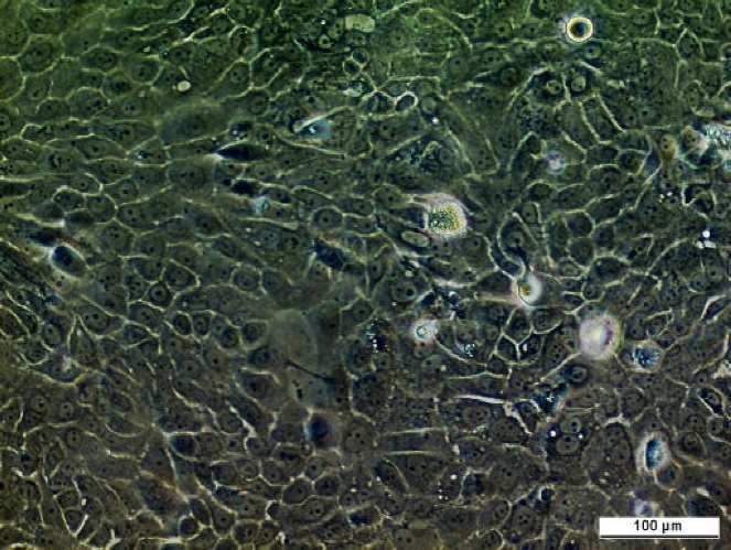 BICR 56 Cell Line. Image courtesy of the European Collection of Authenticated Cell Cultures (ECACC)