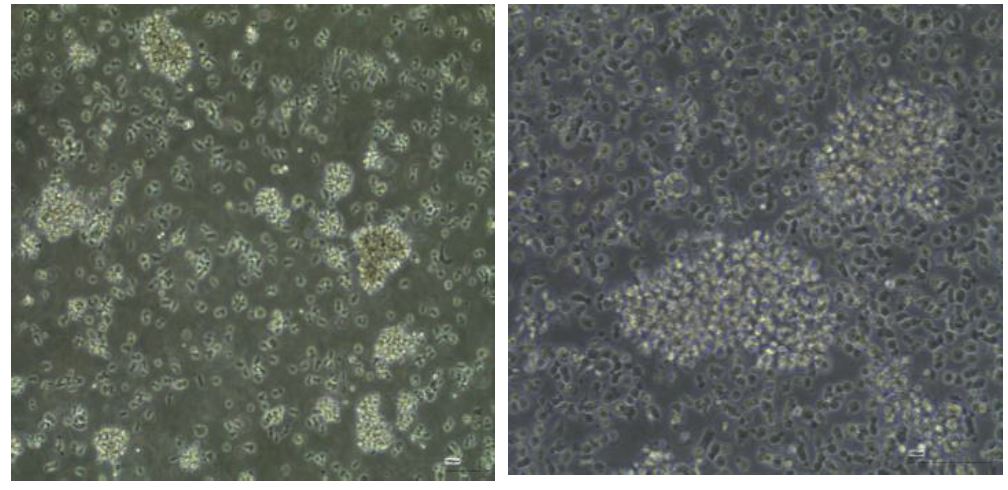 MHYO-LCL2 Cell Line

Unpublished Images. 