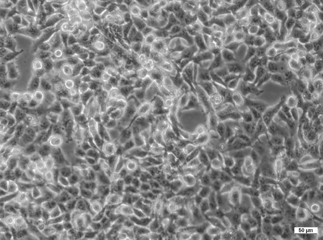 2fTGH-U3A Cell Line. Image courtesy of the European Collection of Authenticated Cell Cultures (ECACC)