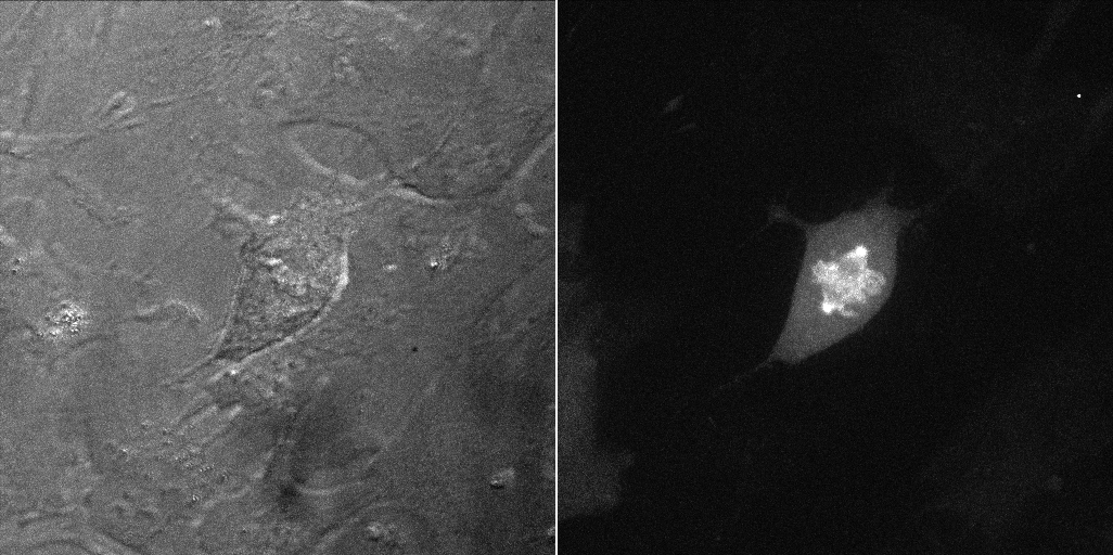 Cyclin B1-Venus Reporter Cell line [RPE1 cycB1-venus/+ KI clone 20G11] Metaphase, example 1