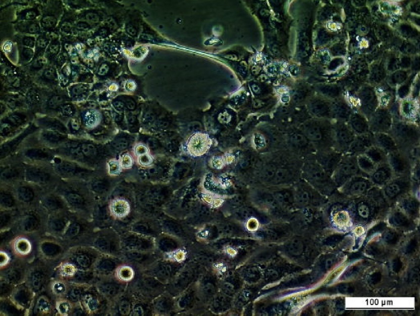 BICR 16 Cell Line. Image courtesy of the European Collection of Authenticated Cell Cultures (ECACC)