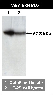 Image for Anti-TCPb [F39P7F11]