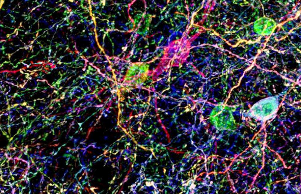 Image for Anti-PhiYFP (Chicken) "Brainbow" polyclonal antibody