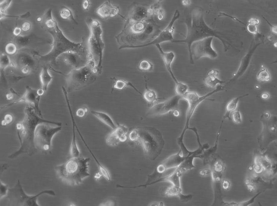 BICR 78 Cell Line. 48 hours post plating. Image courtesy of the European Collection of Authenticated Cell Cultures (ECACC).