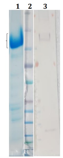 Figure 1. Coomassie and WB blot of S1-His protein. Lane 1 = Purified 12.5ug total (SDS coomassie); Lane 2 = Marker; Lane 3 = Crude extract (WB) detected with anti-His at 1/2000 and anti-mouse HRP at 1/2500.
Notes: The expression of S1-His was observed at 100kDa (SDS PAGE) and predicted size using CLC is 80kDa. The predicted number of N-glycan sites using NetNGlyc 1.0 server: 13 Predicted size with N-glycans: 106KDa (assuming each glycan gave 2KDa).
