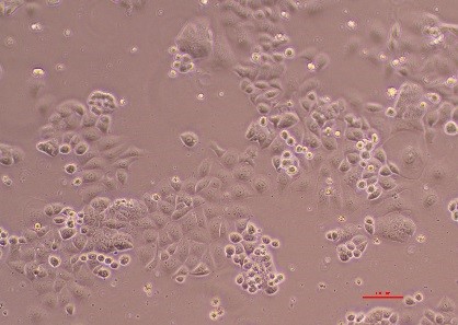 BR45 Cell Line - image captured with a x10 Objective.