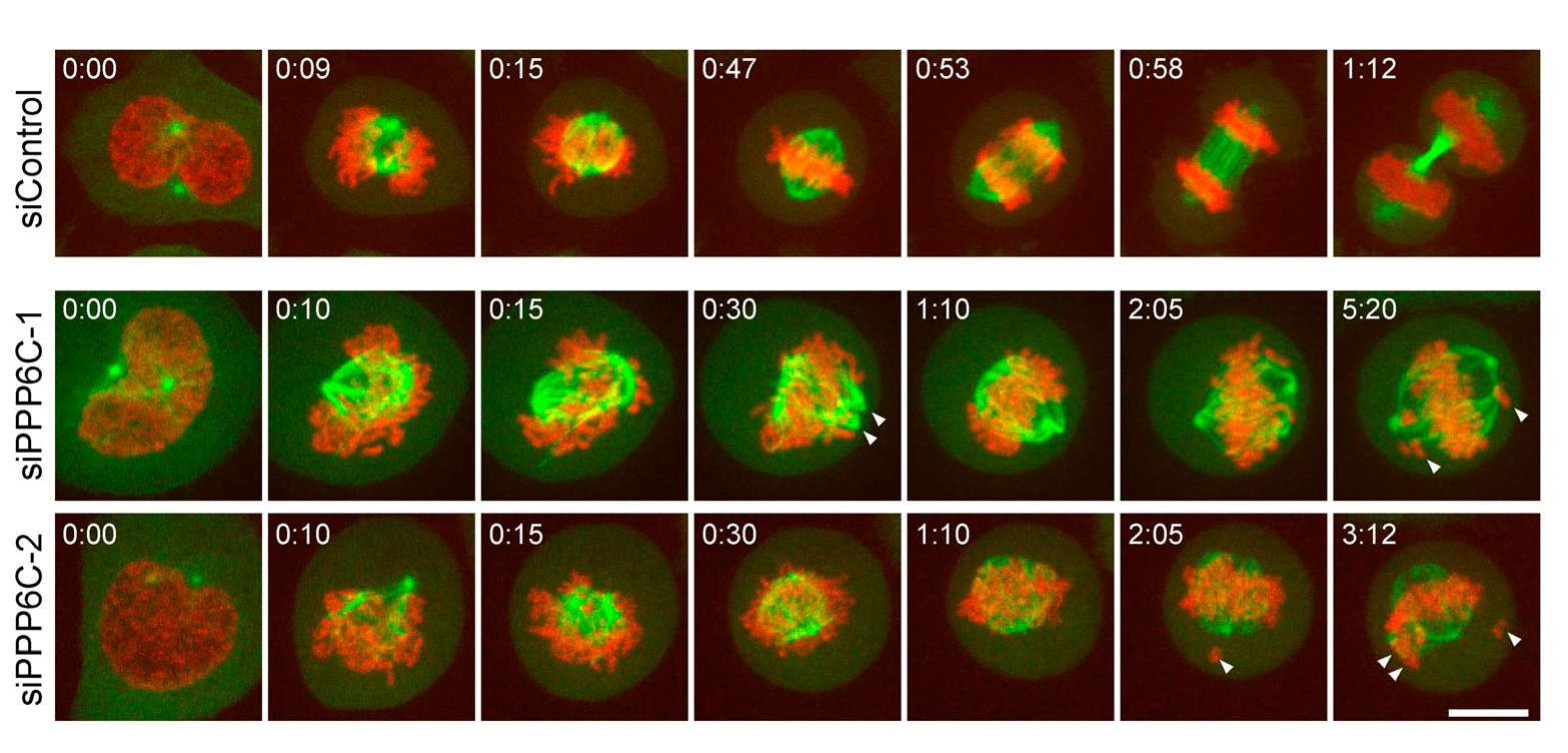 ©2010 Zeng et al. J Cell Biol. Dec 27;191(7):1315-32. doi: 10.1083/jcb.201008106.  

HeLa cells stably expressing mCherry-tagged histone H2B and EGFP-tagged α-tubulin were transfected for 48 h with control or protein phosphatase 6 catalytic subunit (PPP6C) si08 duplexes and then imaged every minute at three stage positions for 10 h using a spinning-disk confocal microscope (Ultraview Vox). Laser setting were 3% with 30-ms exposure per channel, and 35 optical sections spaced 0.5 μm apart were taken for both channels. Representative examples of cells passing through mitosis are shown. The times are given in hours and minutes. Arrowheads mark abnormal spindle poles and lagging chromosomes. Bar, 10 μm.
