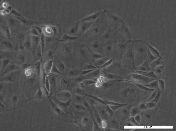 PEA2 Cell Line. Image courtesy of the European Collection of Authenticated Cell Cultures (ECACC)