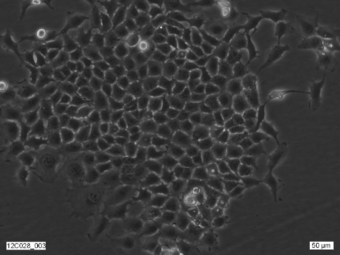 2fTGH-U4C Cell Line. Image courtesy of the European Collection of Authenticated Cell Cultures (ECACC)