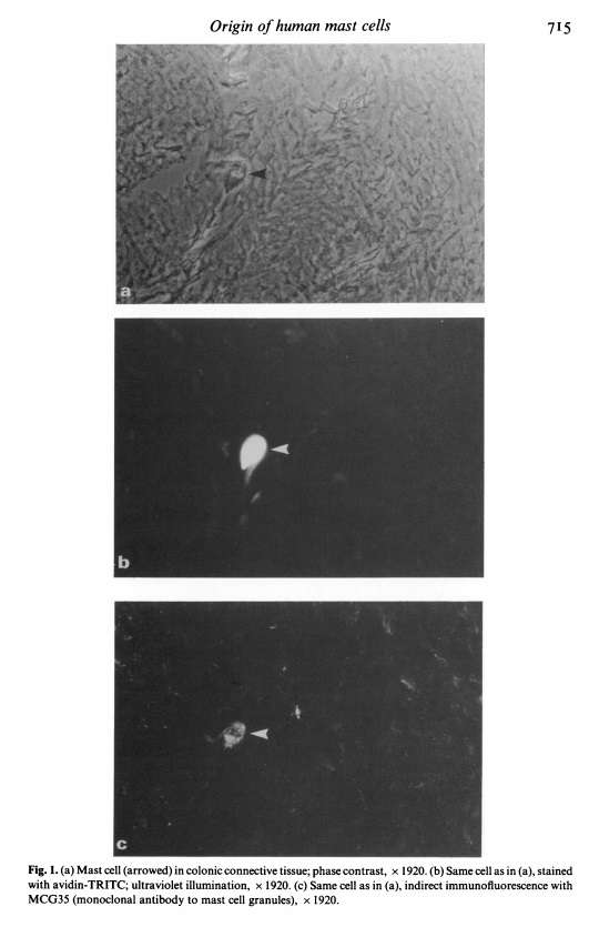 Adapted from Rimmer EF, Horton MA. Origin of human mast cells studied by dual immunofluorescence. Clin Exp Immunol. 1987 Jun;68(3):712-8. PMID: 3308221; PMCID: PMC1542749. (a) Mast cell (arrowed) in colonic connective tissue; phase contrast, x 1920. (b) Same cell as in (a), stained
with avidin-TRITC; ultraviolet illumination, x 1920. (c) Same cell as in (a), indirect immunofluorescence with
MCG35 (monoclonal antibody to mast cell granules), x 1920.