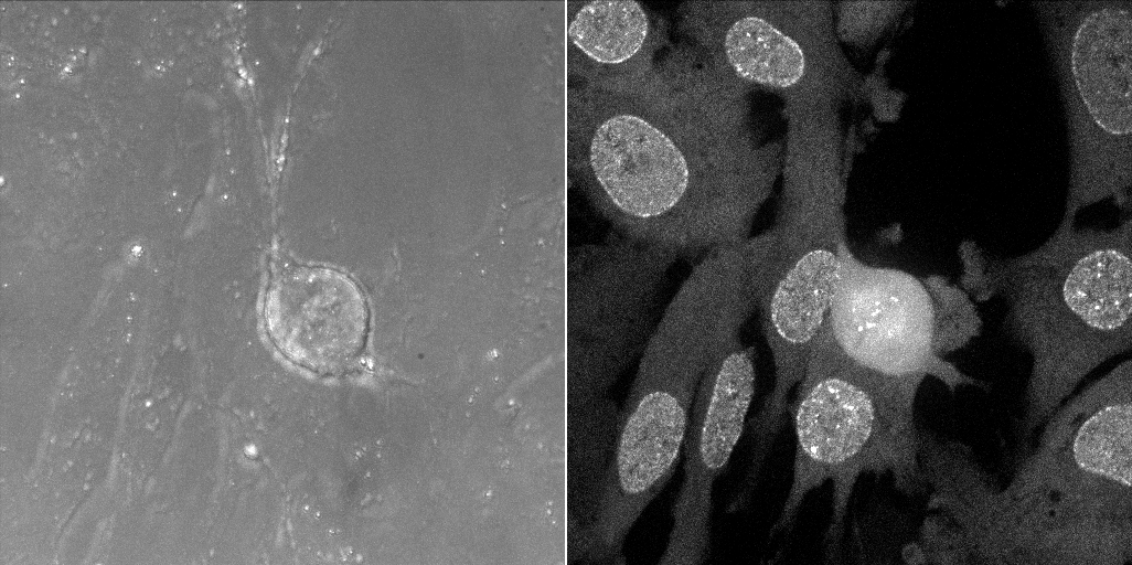 Venus-Mad2 Reporter Cell Line [RPE1 Venus-Mad2/+ KI clone #1] Metaphase