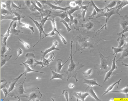 MEF ULK1 KO (SV40) Cell Line. 24 hours post plating. Image courtesy of the European Collection of Authenticated Cell Cultures (ECACC)