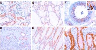 MONOCLONAL ANTIBODY