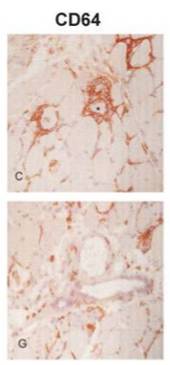 Immunostaining in polymyositis