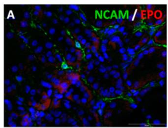 Double immunofluorescent labelling of NCAM