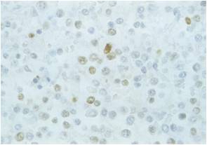 Immunohistochemical analysis